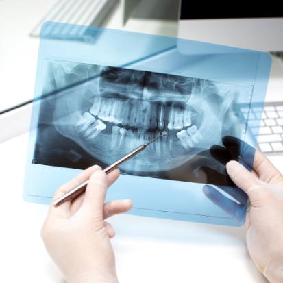 De Schans Dentists Root Canal Treatment